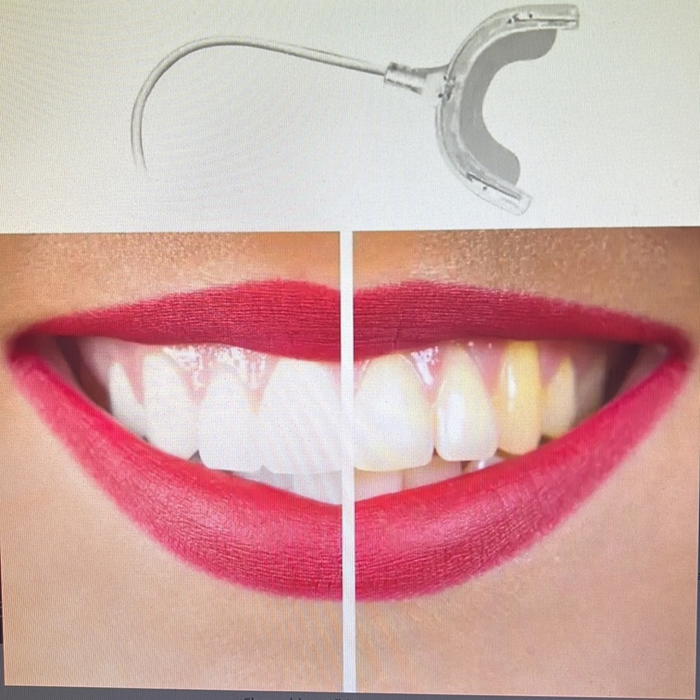 Blue ray, dental tray - Picture 3 of 6